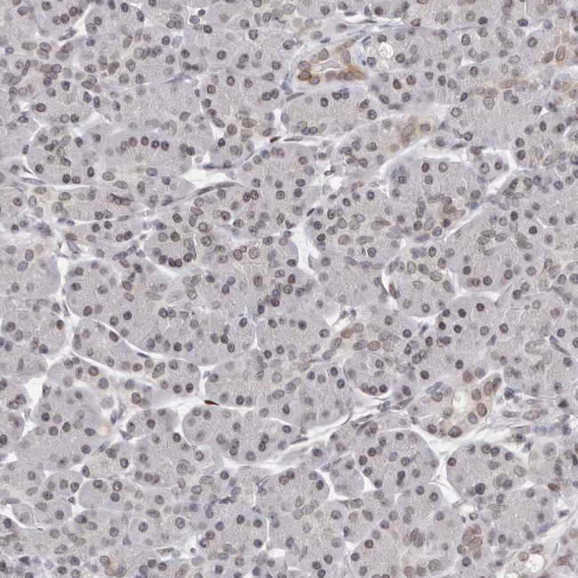 NUP153 Antibody in Immunohistochemistry (IHC)