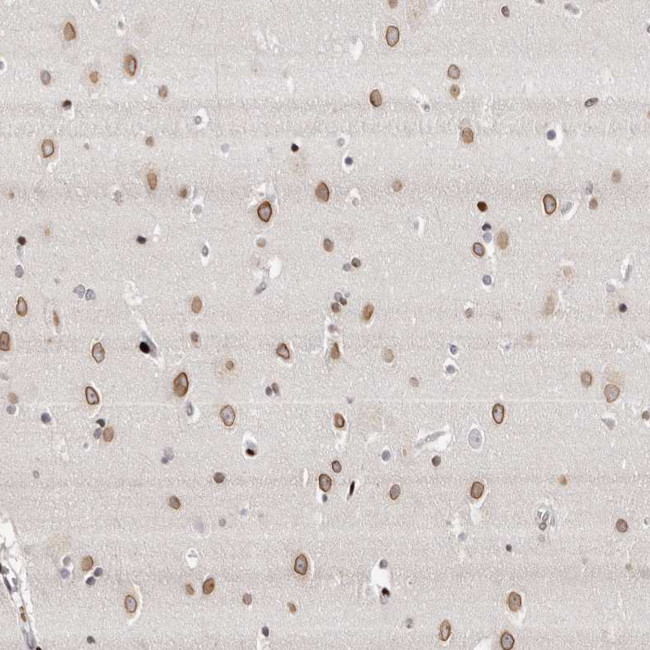 NUP153 Antibody in Immunohistochemistry (IHC)