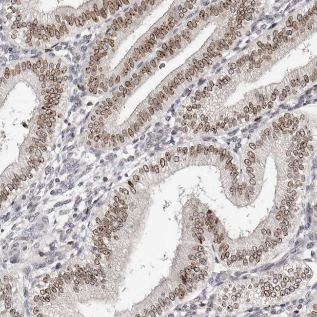 NUP153 Antibody in Immunohistochemistry (IHC)