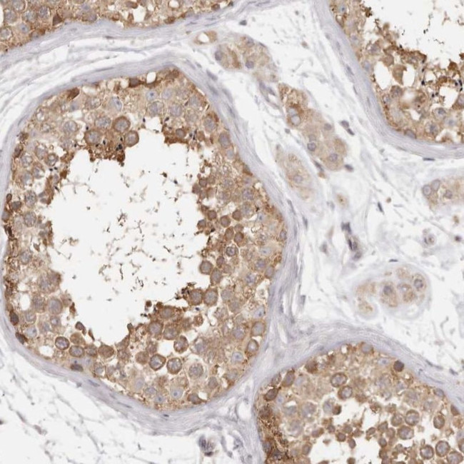 EEF1E1 Antibody in Immunohistochemistry (IHC)