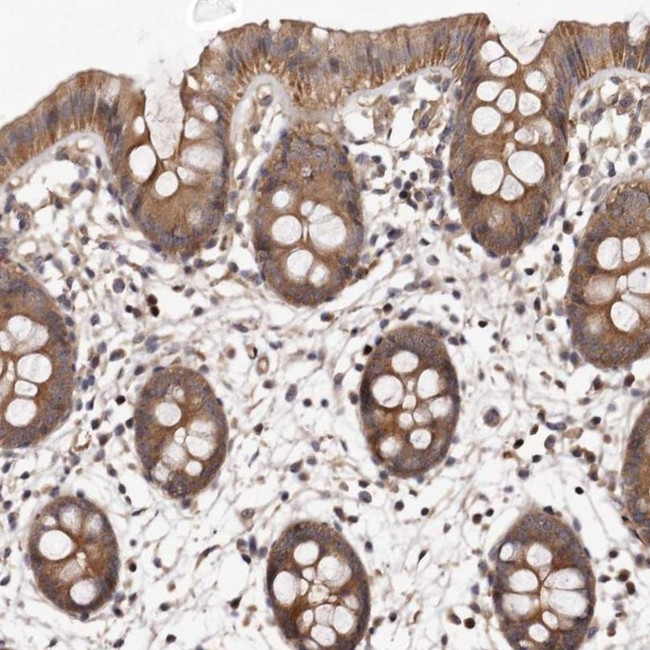 PANK4 Antibody in Immunohistochemistry (IHC)