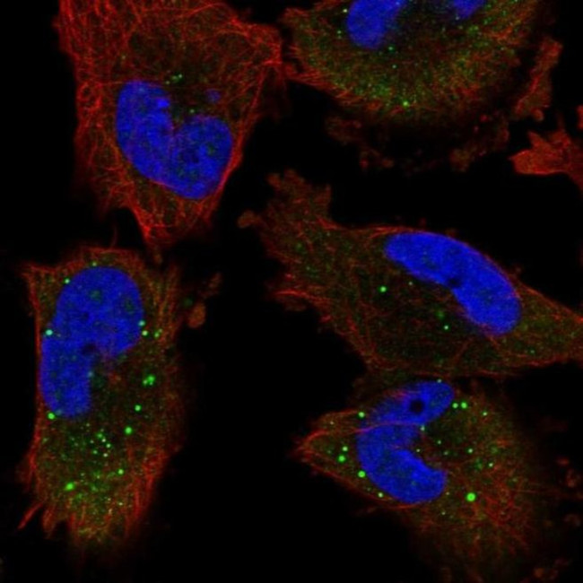 UNK Antibody in Immunocytochemistry (ICC/IF)