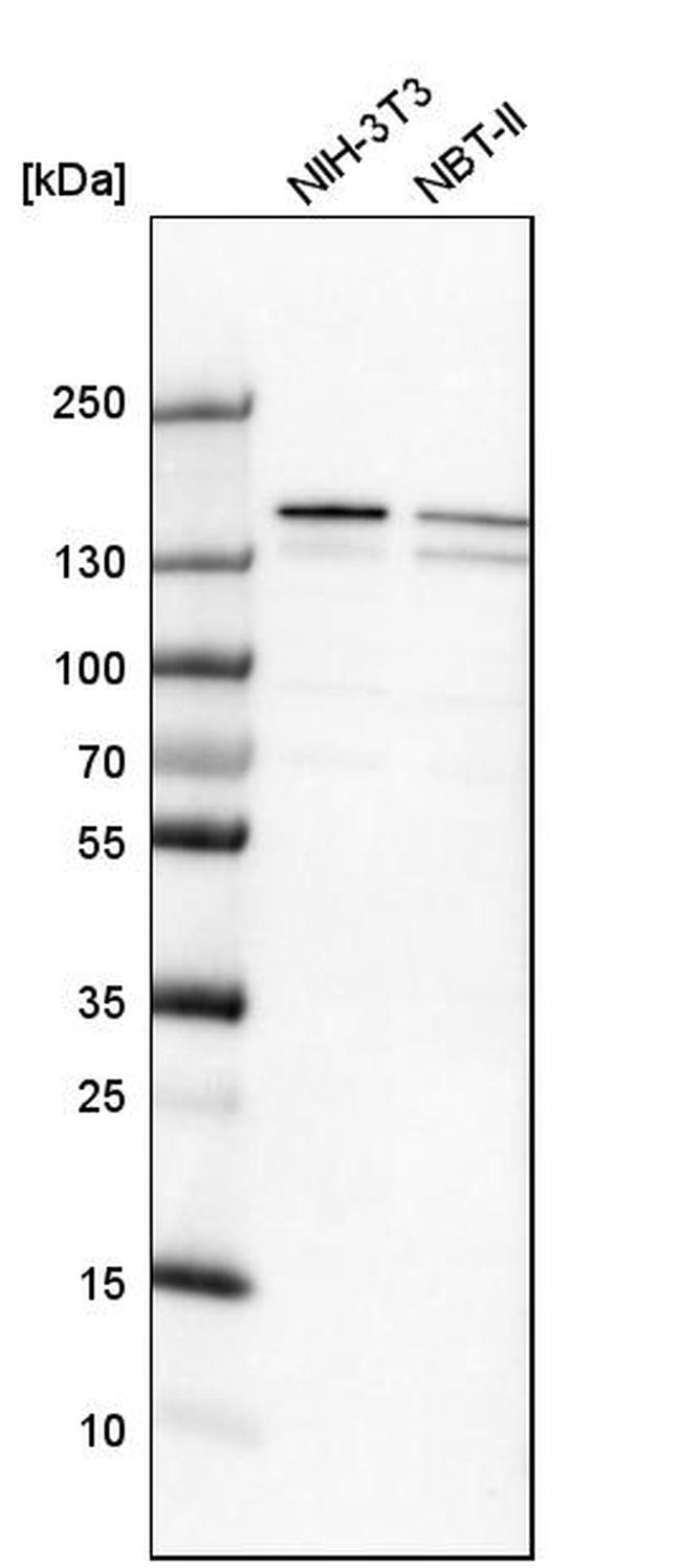 DHX9 Antibody in Western Blot (WB)