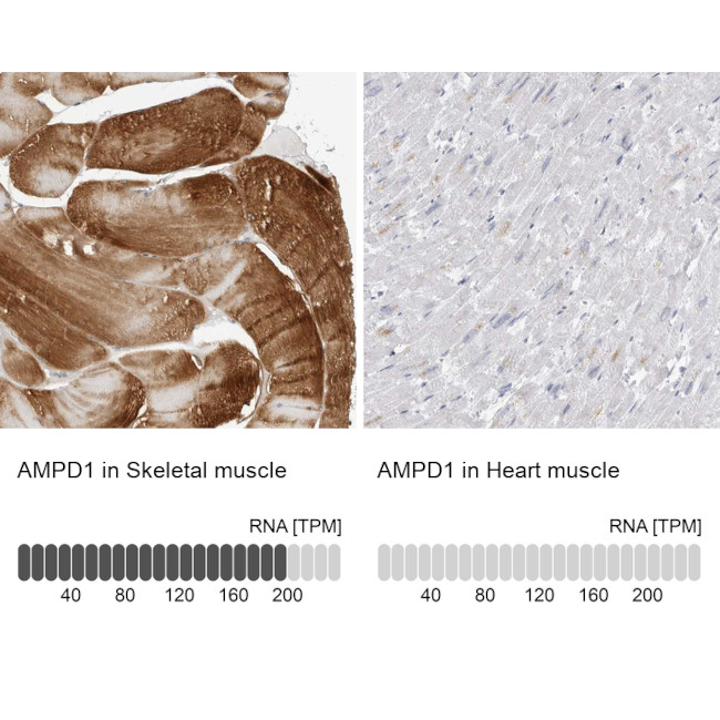 AMPD1 Antibody in Immunohistochemistry (IHC)