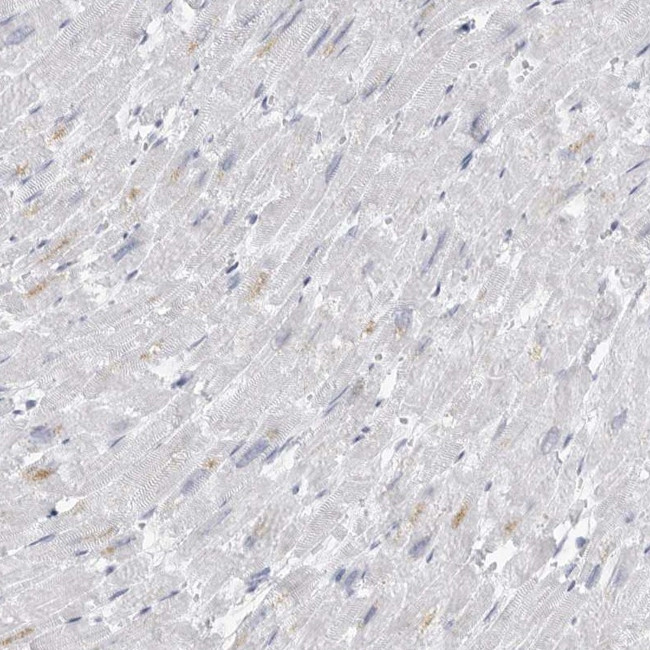 AMPD1 Antibody in Immunohistochemistry (IHC)