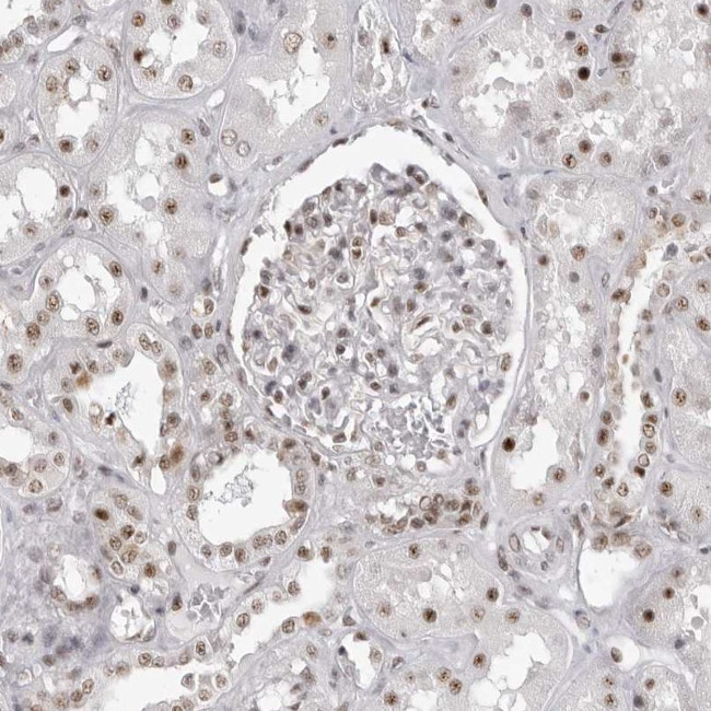 WRAP53 Antibody in Immunohistochemistry (IHC)