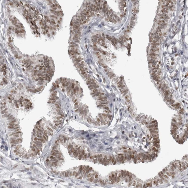 WRAP53 Antibody in Immunohistochemistry (IHC)