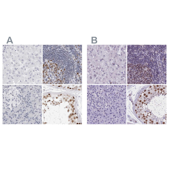 NASP Antibody in Immunohistochemistry (IHC)