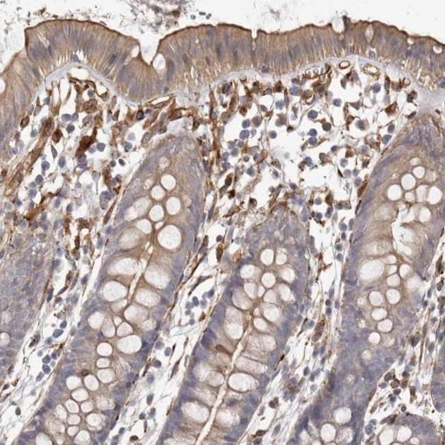 WDTC1 Antibody in Immunohistochemistry (IHC)