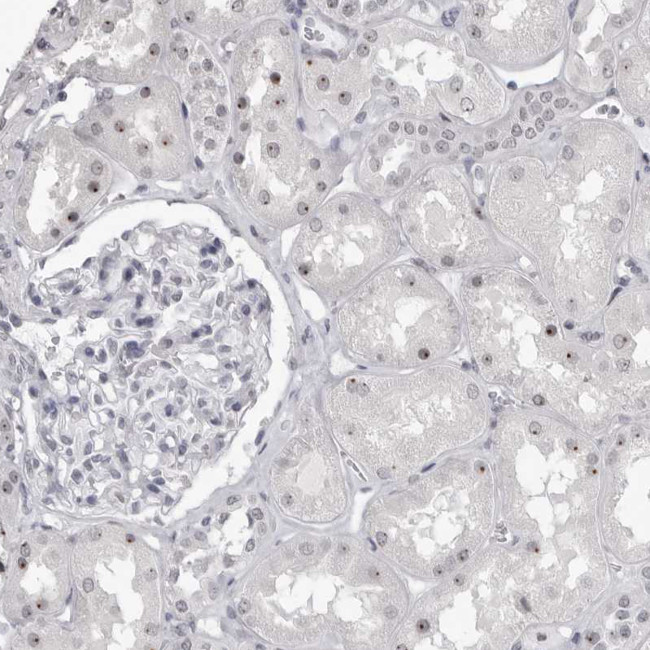 DDX54 Antibody in Immunohistochemistry (IHC)