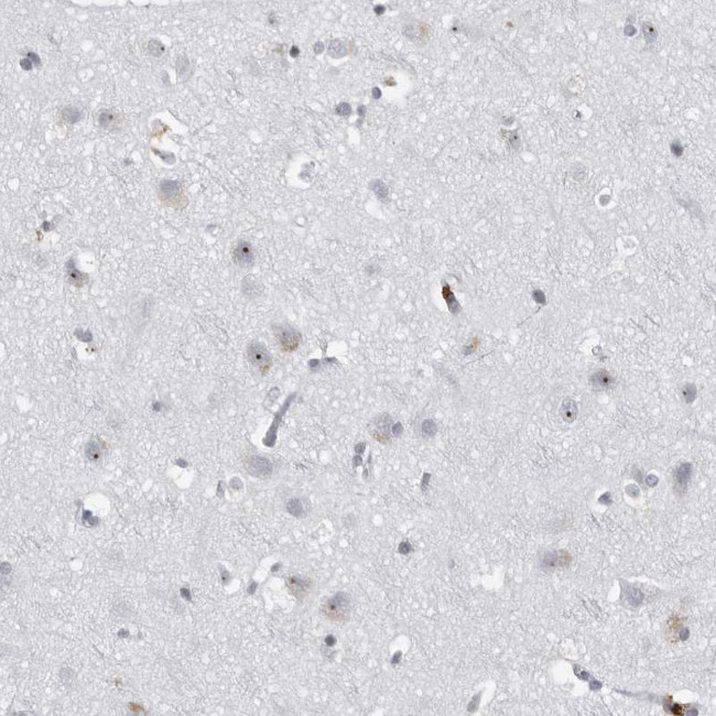 DDX54 Antibody in Immunohistochemistry (IHC)