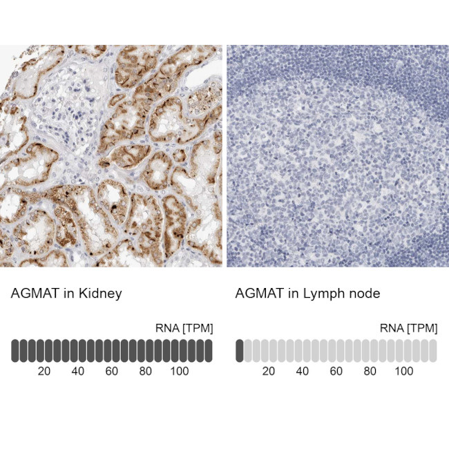 AGMAT Antibody in Immunohistochemistry (IHC)