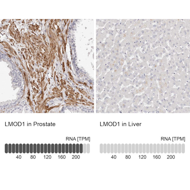 LMOD1 Antibody in Immunohistochemistry (IHC)