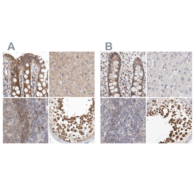 RALGPS2 Antibody in Immunohistochemistry (IHC)