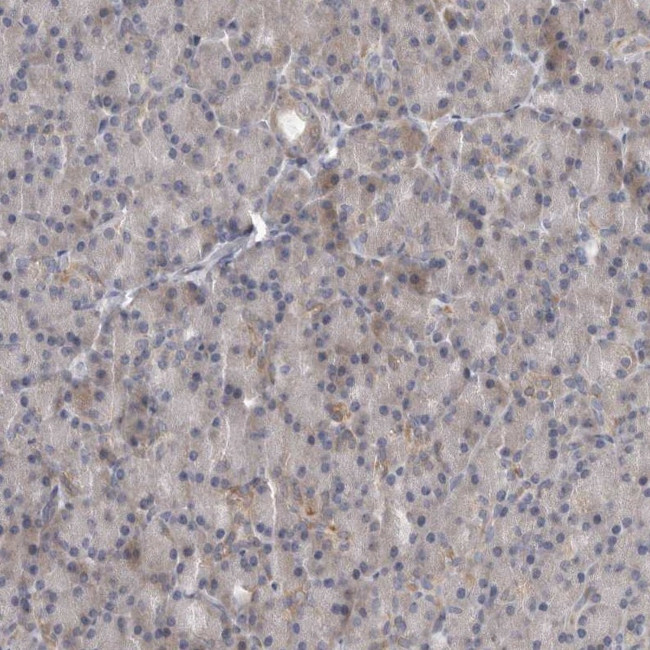 RALGPS2 Antibody in Immunohistochemistry (IHC)