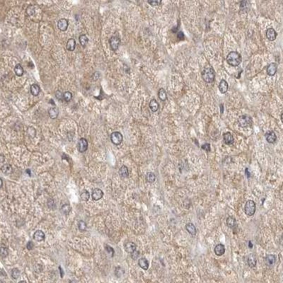 RALGPS2 Antibody in Immunohistochemistry (IHC)