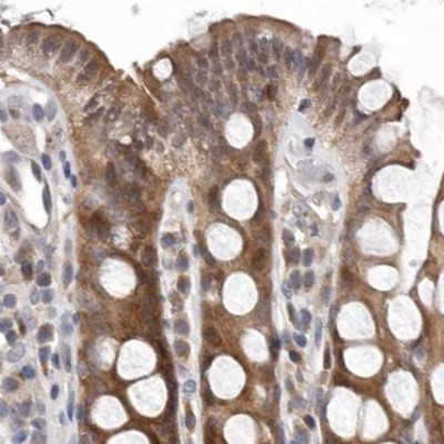 RALGPS2 Antibody in Immunohistochemistry (IHC)