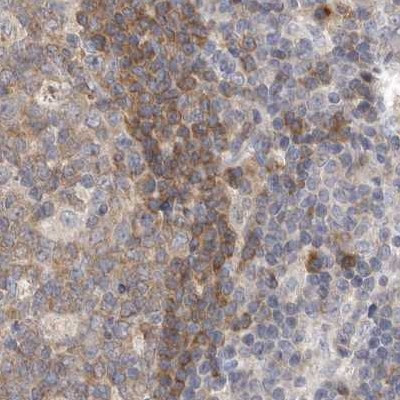 RALGPS2 Antibody in Immunohistochemistry (IHC)