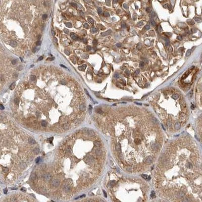 CEP350 Antibody in Immunohistochemistry (IHC)