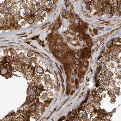 CEP350 Antibody in Immunohistochemistry (IHC)