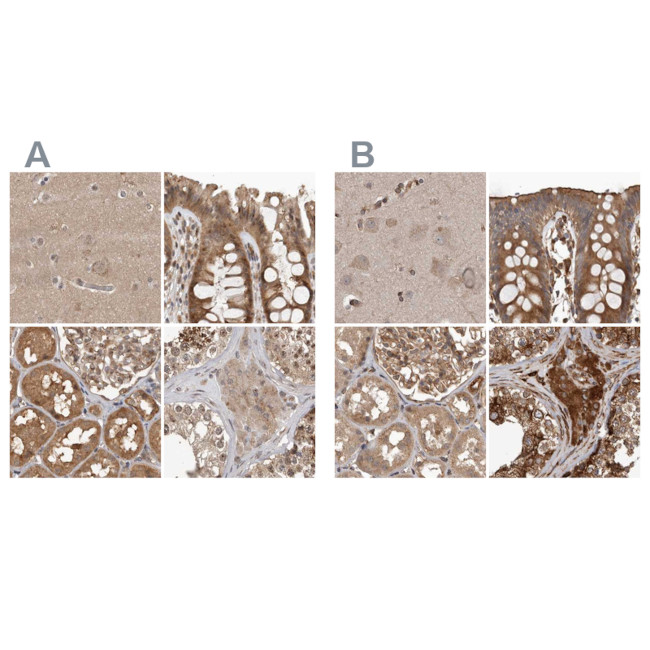 CEP350 Antibody in Immunohistochemistry (IHC)