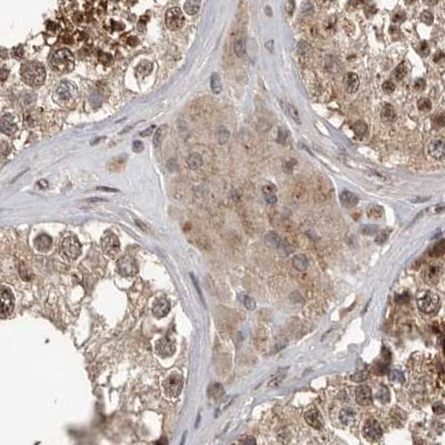 CEP350 Antibody in Immunohistochemistry (IHC)