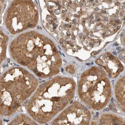 CEP350 Antibody in Immunohistochemistry (IHC)