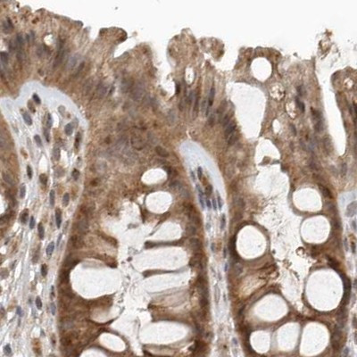 CEP350 Antibody in Immunohistochemistry (IHC)