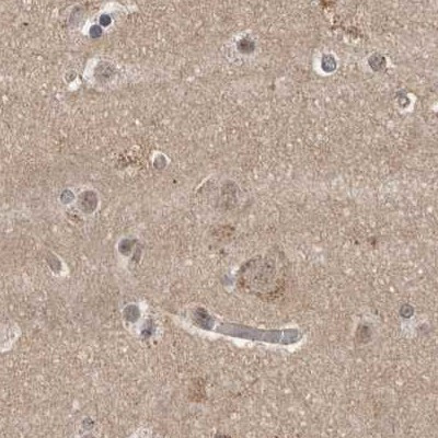 CEP350 Antibody in Immunohistochemistry (IHC)