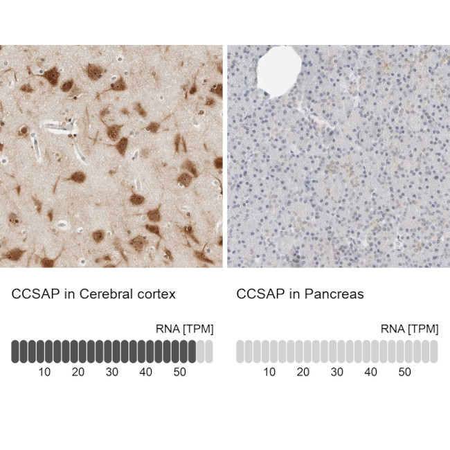 C1orf96 Antibody in Immunohistochemistry (IHC)