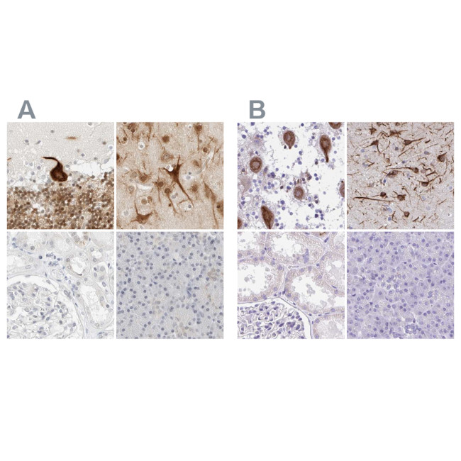 C1orf96 Antibody in Immunohistochemistry (IHC)