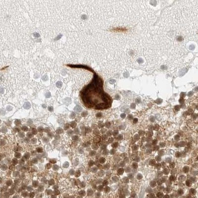 C1orf96 Antibody in Immunohistochemistry (IHC)