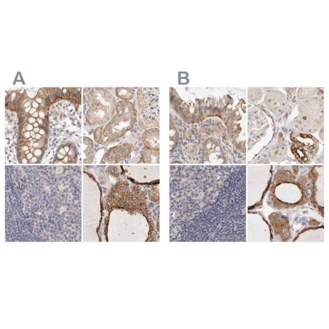 Annexin A9 Antibody in Immunohistochemistry (IHC)