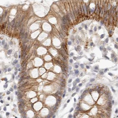 Annexin A9 Antibody in Immunohistochemistry (IHC)