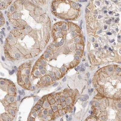 Annexin A9 Antibody in Immunohistochemistry (IHC)