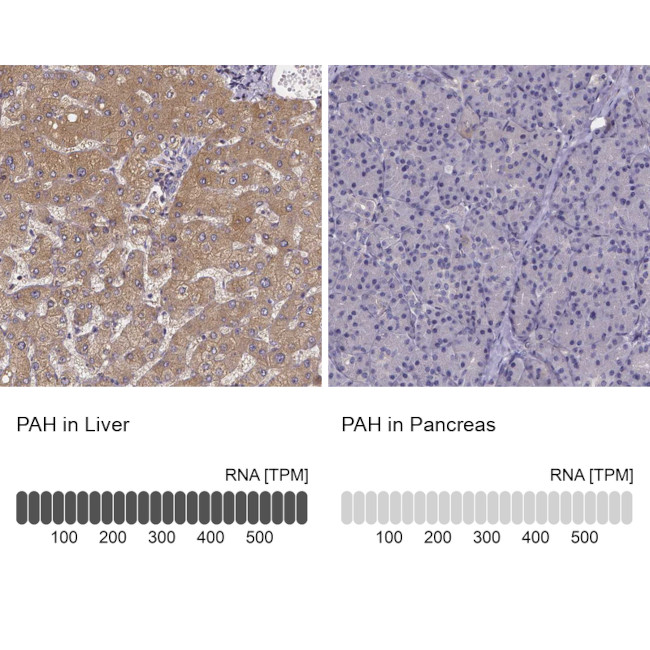 PAH Antibody in Immunohistochemistry (IHC)