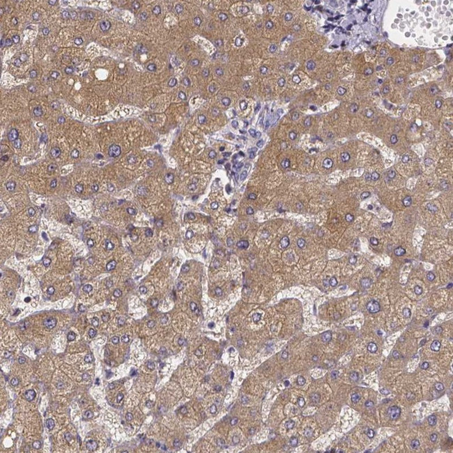 PAH Antibody in Immunohistochemistry (IHC)