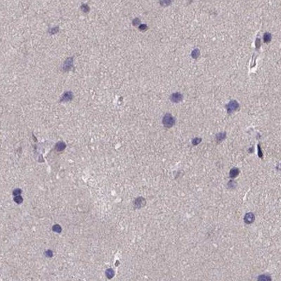 PAH Antibody in Immunohistochemistry (IHC)