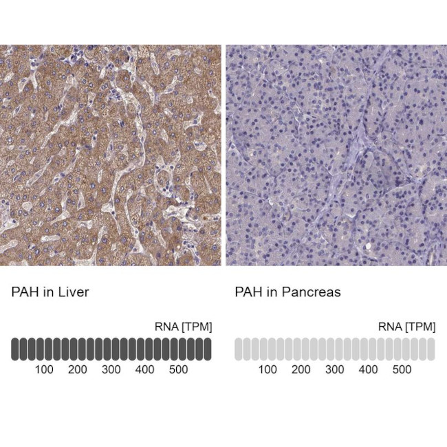 PAH Antibody