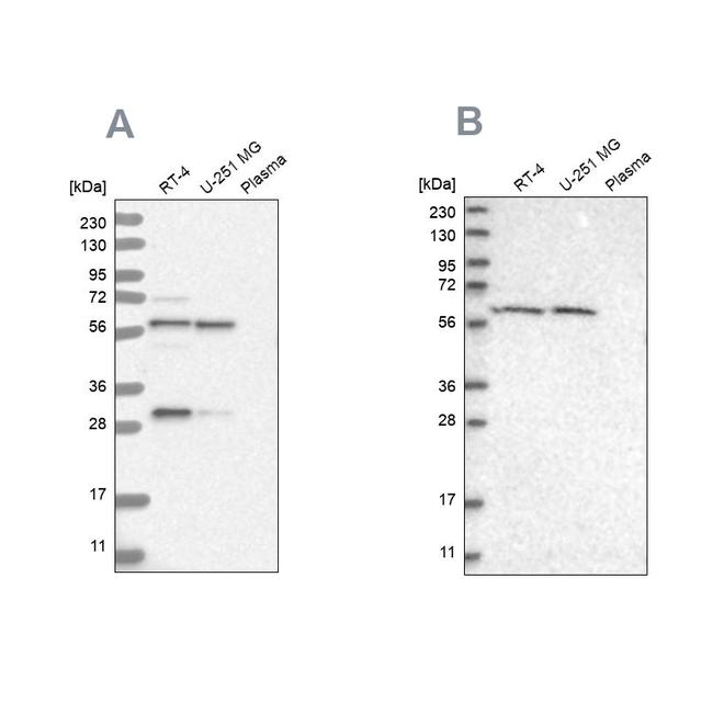 PAH Antibody in Western Blot (WB)