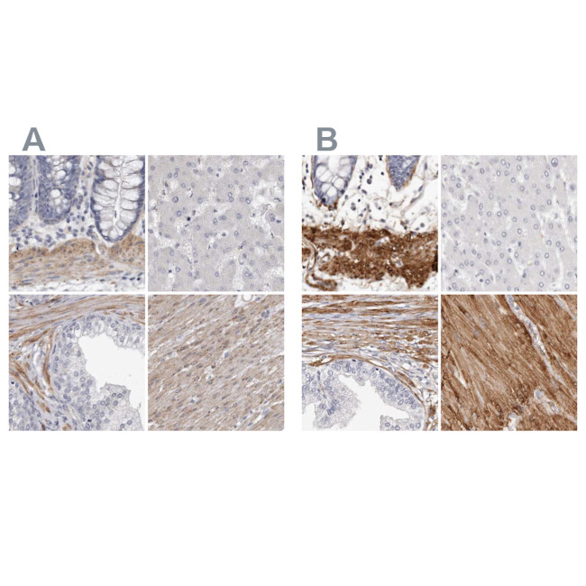 LMOD1 Antibody in Immunohistochemistry (IHC)