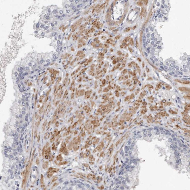 LMOD1 Antibody in Immunohistochemistry (IHC)