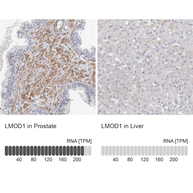 LMOD1 Antibody