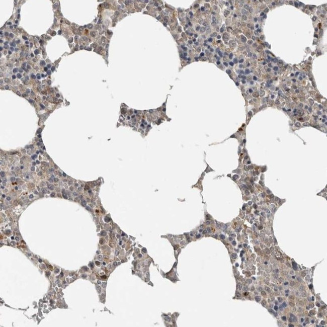 YOD1 Antibody in Immunohistochemistry (IHC)