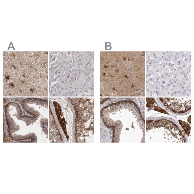 ENAH Antibody in Immunohistochemistry (IHC)