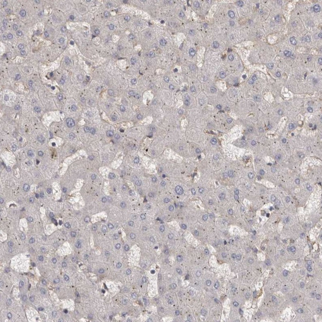 ENAH Antibody in Immunohistochemistry (IHC)