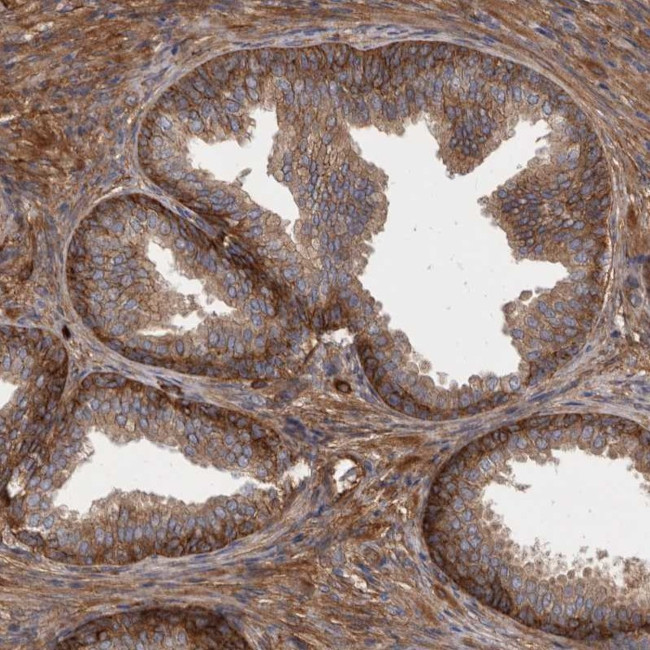 ENAH Antibody in Immunohistochemistry (IHC)