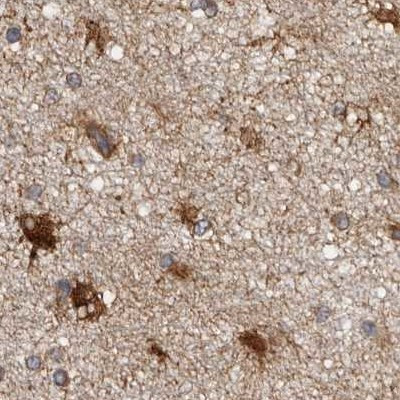 ENAH Antibody in Immunohistochemistry (IHC)