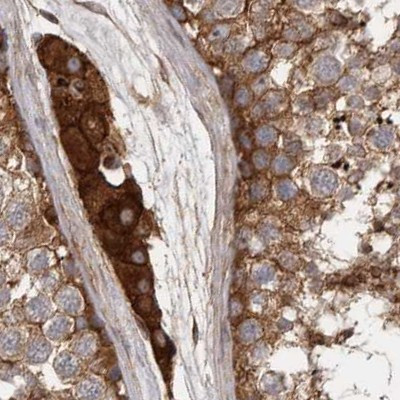 ENAH Antibody in Immunohistochemistry (IHC)