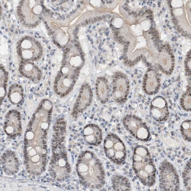 C1orf131 Antibody in Immunohistochemistry (IHC)